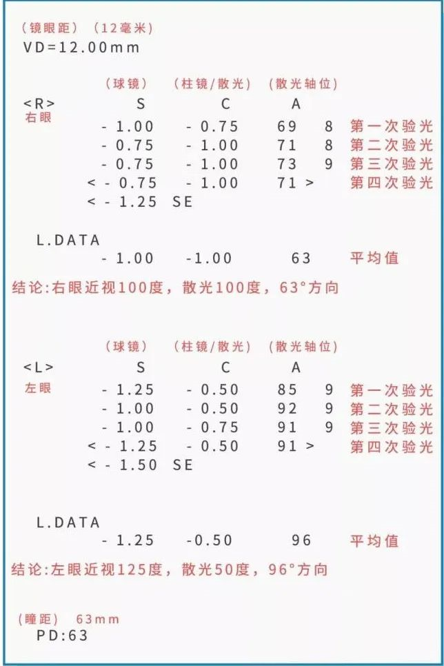 建議收藏！眼睛驗(yàn)光報(bào)告單這樣看！