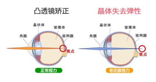 老花眼示意圖