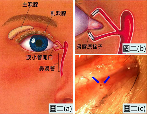 干眼癥,眼睛干澀,眼干癥,惠州?，斞劭漆t(yī)院