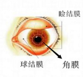 角膜炎,角膜鱗狀,角膜穿孔,惠州?，斞劭漆t(yī)院