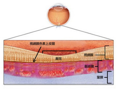 眼中漿嚴(yán)重嗎？可以治好嗎